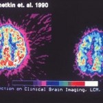 通过脑部扫描来说明记忆技术是如何激活右脑的