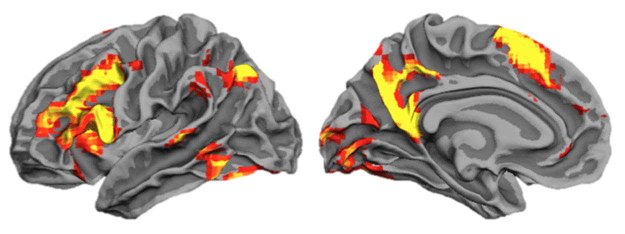 大脑扫描强记忆，以说明内存改善和磁存记忆方法MasterClass有助于学习者