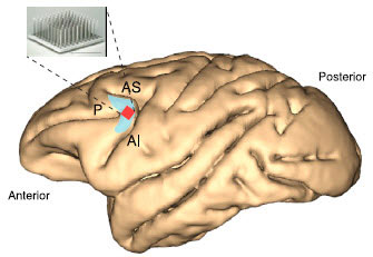 大脑的前部和后部皮层